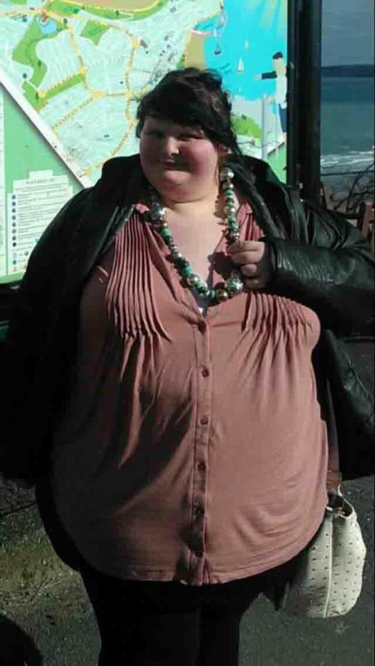 παχύσαρκη γυναίκα